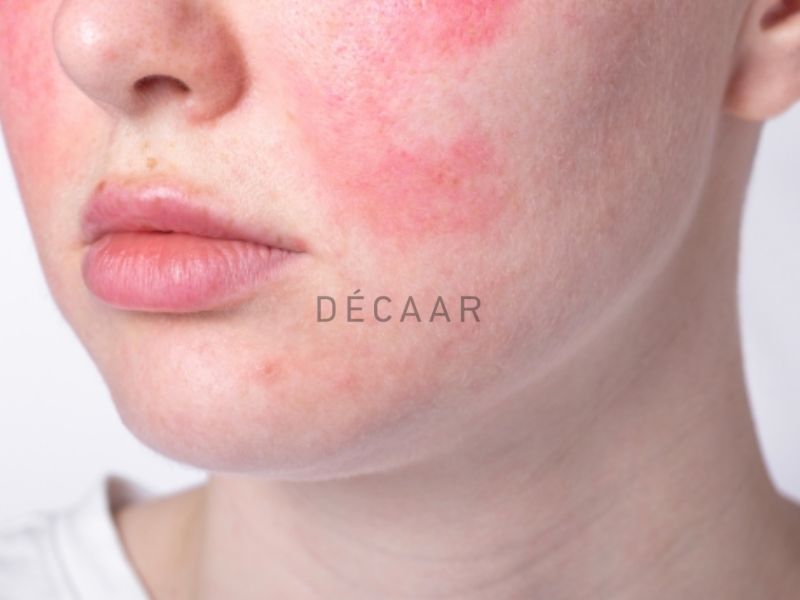 Những triệu chứng có thể gặp sau khi peel da